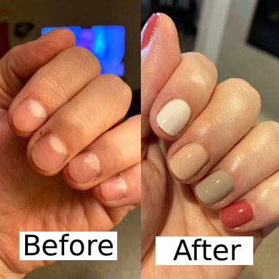 Olumia™ Nail Fungus Oil