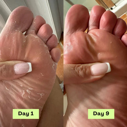 Olumia™ Nail Fungus Oil