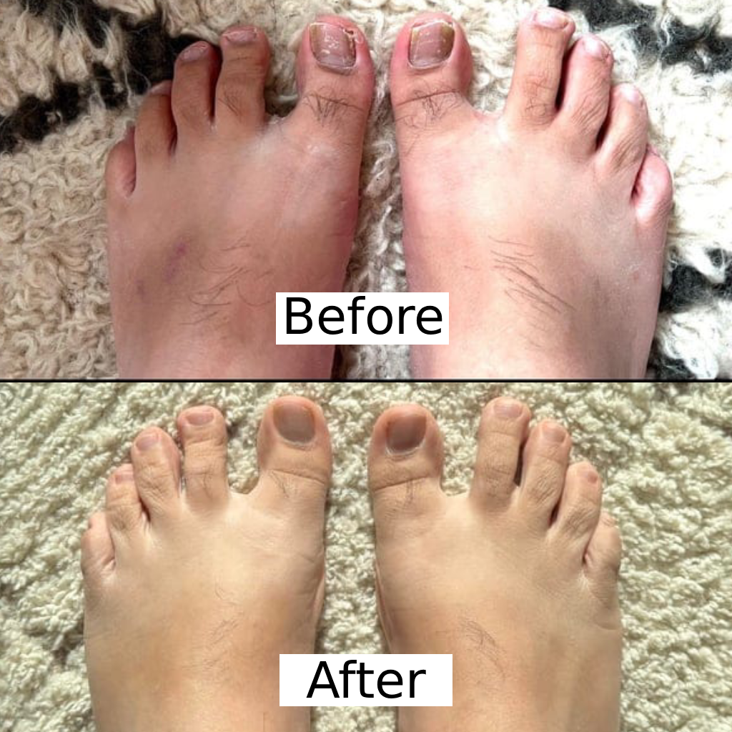 Olumia™ Nail Fungus Oil