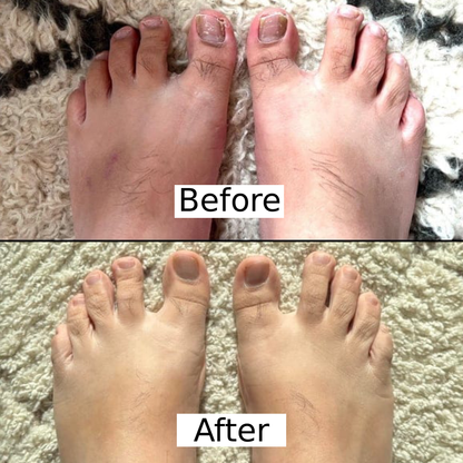 Olumia™ Nail Fungus Oil