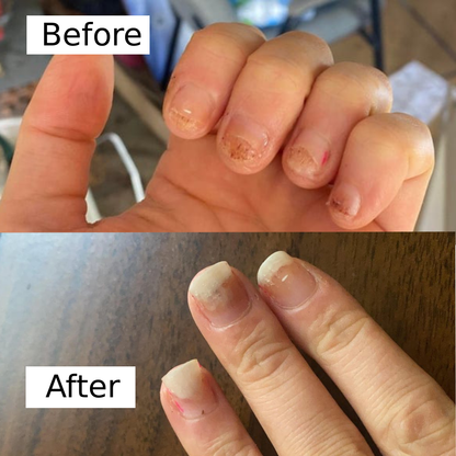 Olumia™ Nail Fungus Oil